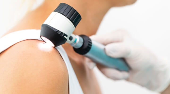 Doctor examining skin on a woman's shoulder