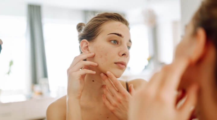 Woman looking at skin in mirror